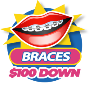 Braces-100-down-300x300-jun-2024